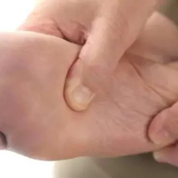 Plantar Fasciitis Specialist Raleigh NC